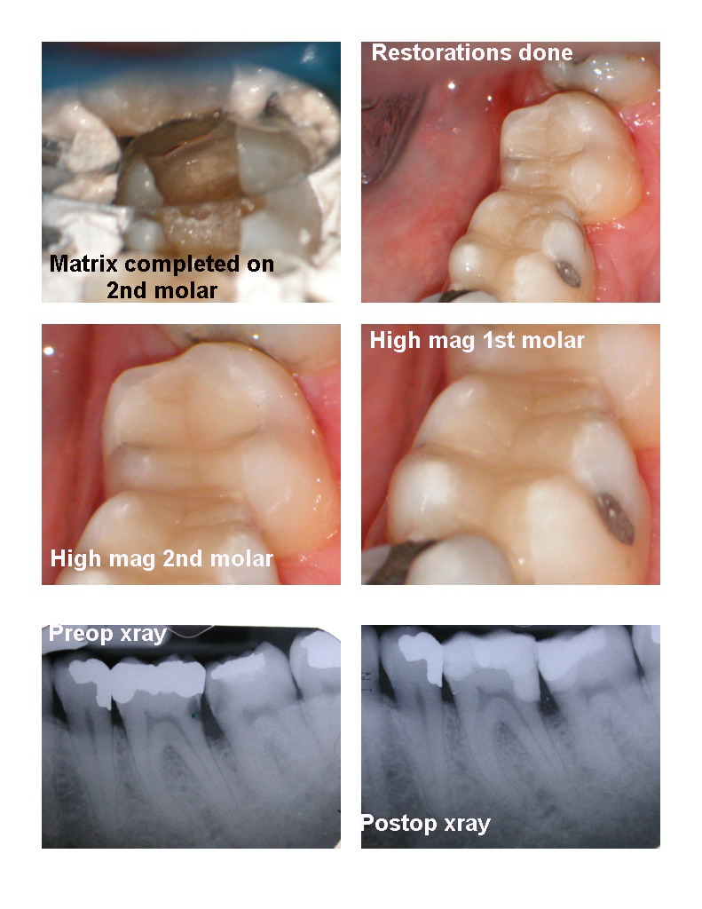 Deep Cavities pg 3.jpg